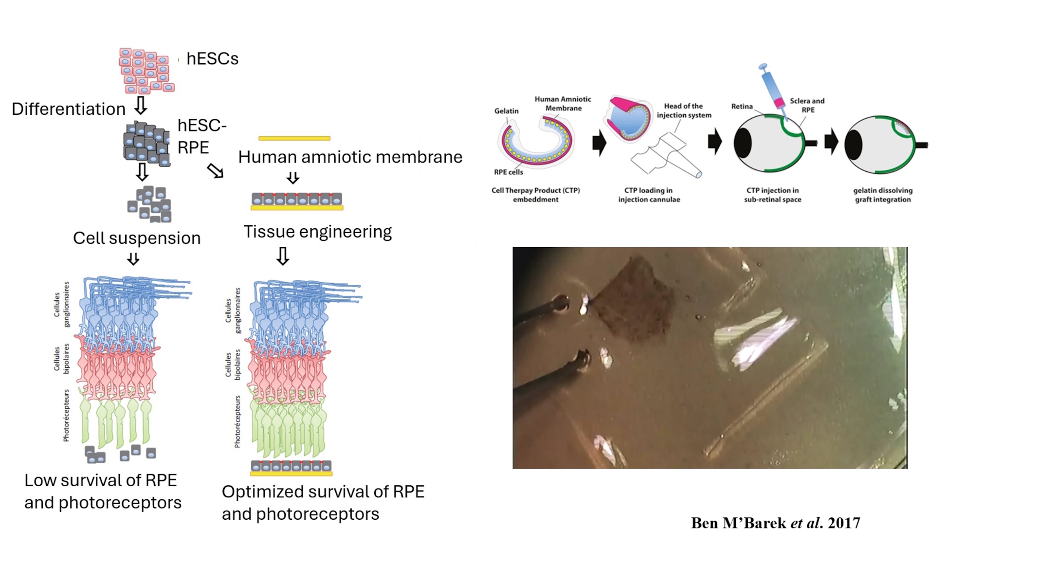 Rétinopathies