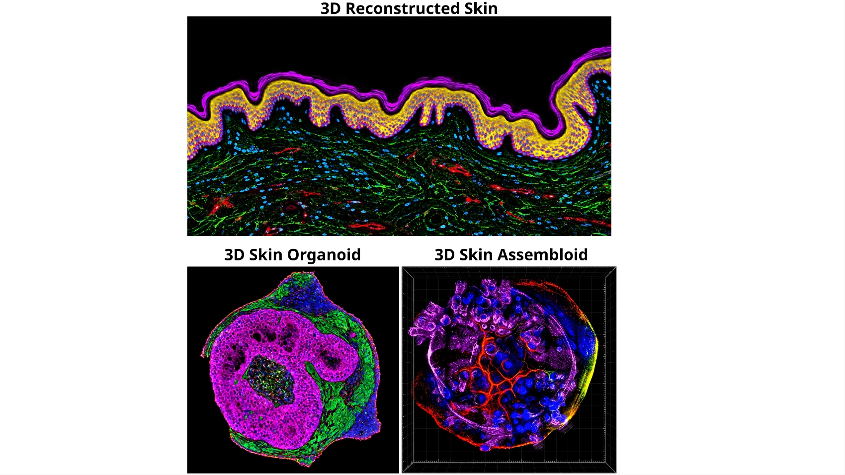 Genodermatoses