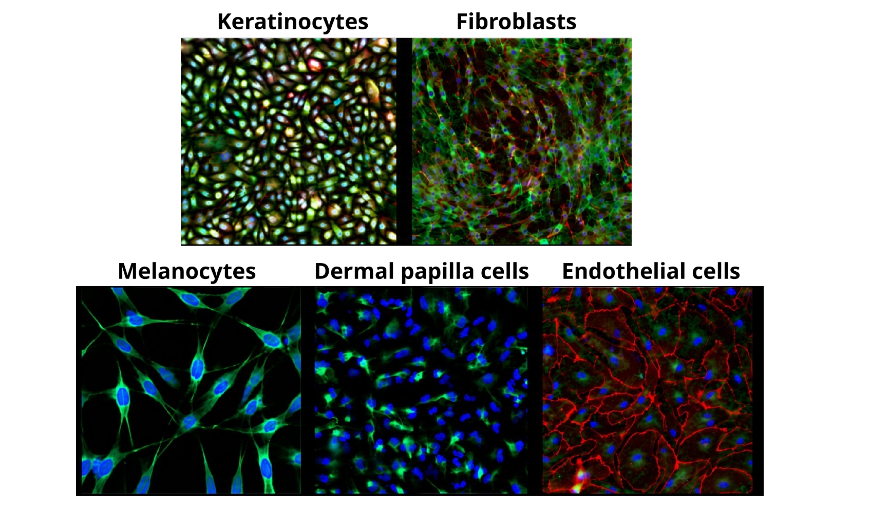 Genodermatoses
